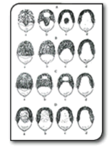 La ricetta di una maschera per capelli di uovo e cipolle